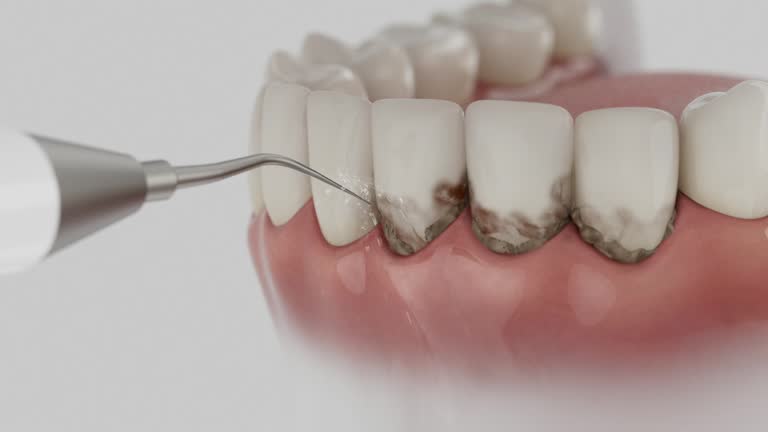 Reliable Dental contractor in Wrangell, AK by Dentist Open Now